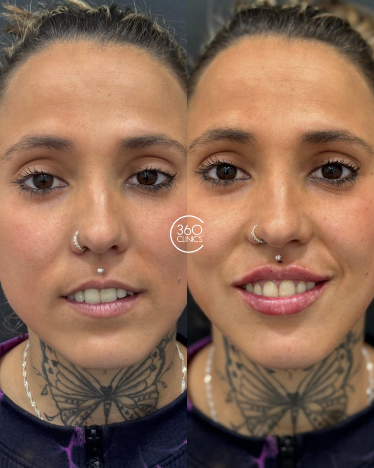 Labios (6)