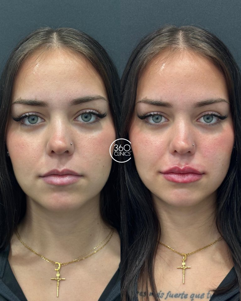 Labios (7)